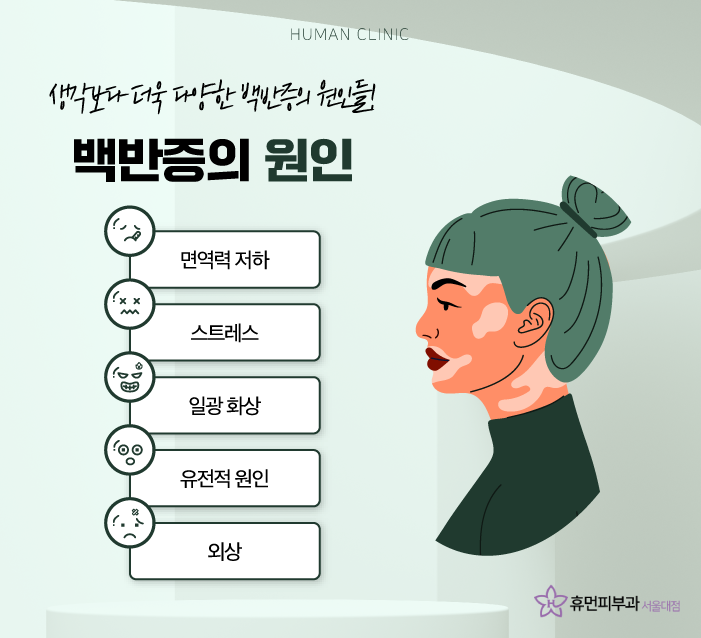 이수역피부과 백반증치료백반증원인을 알아보고 치료할 수 있는 방법은 관련 이미지 3