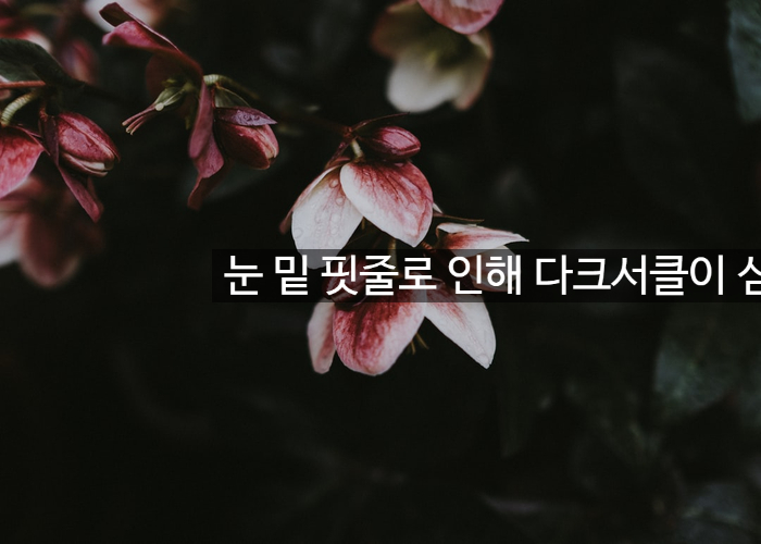눈 밑 핏줄로 인해 다크서클이 심한데 수술하면 영구적으로 없앨 수 있나요? 부작용은 없나요? 알아볼까 관련 이미지 1