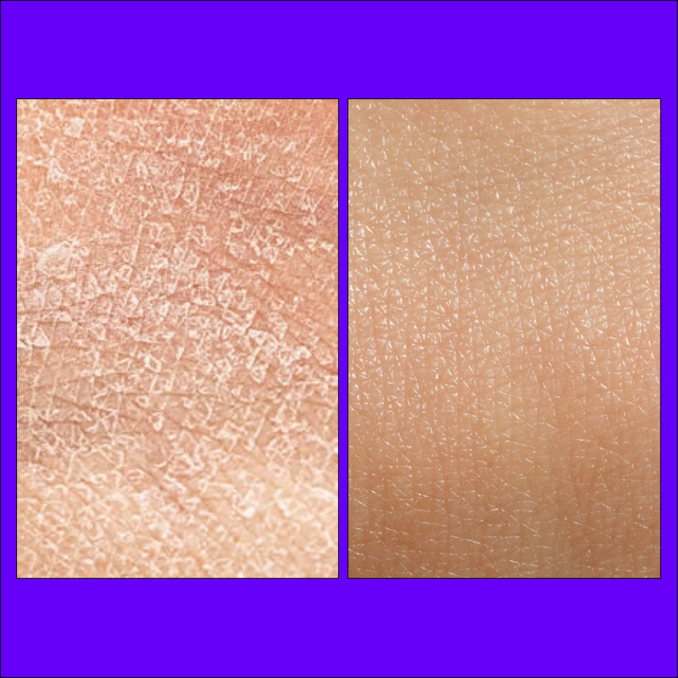 Sadang Dermatology: What Is the Right Choice for Dry Skin? image 1