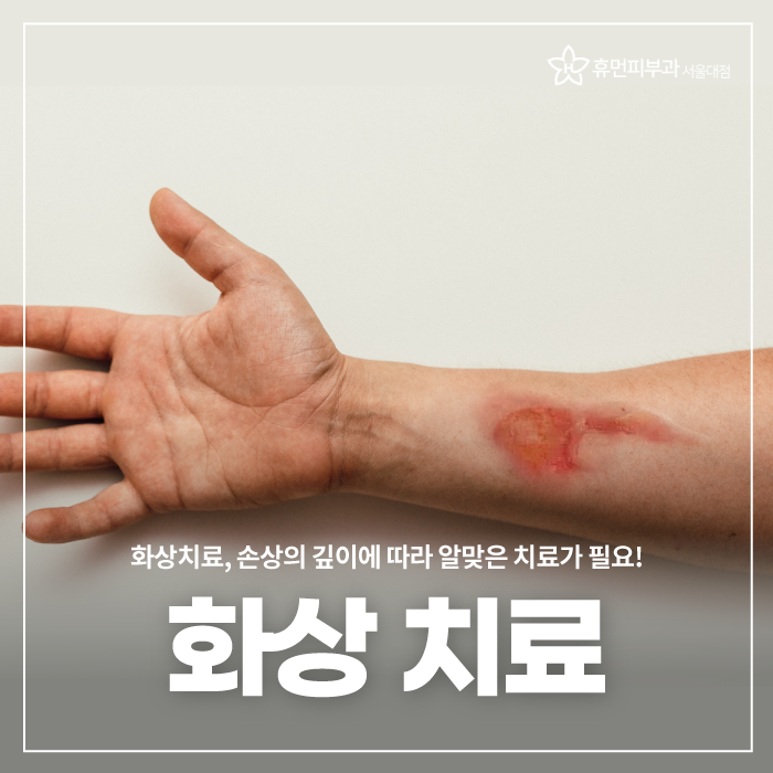 서울대입구역피부과 화상을 입으셨다면 관련 이미지 1