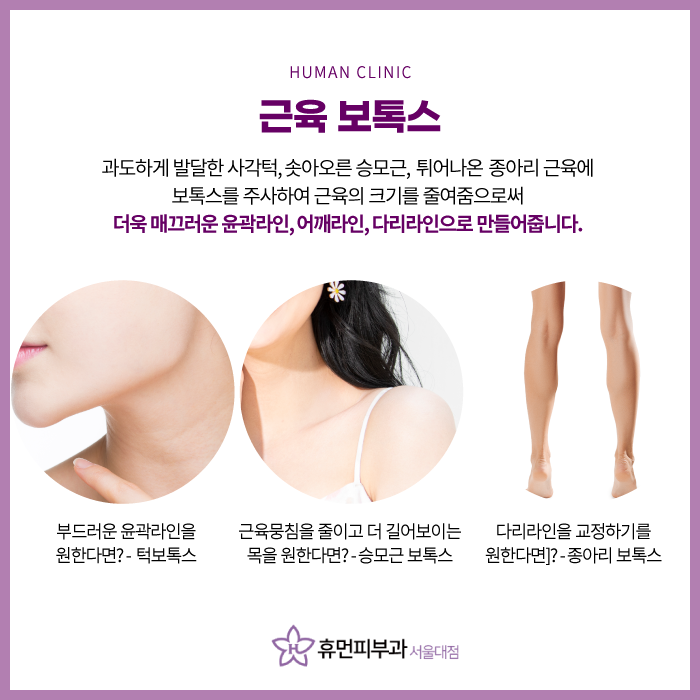 서울보톡스 티 안 나게 예뻐지자 관련 이미지 4