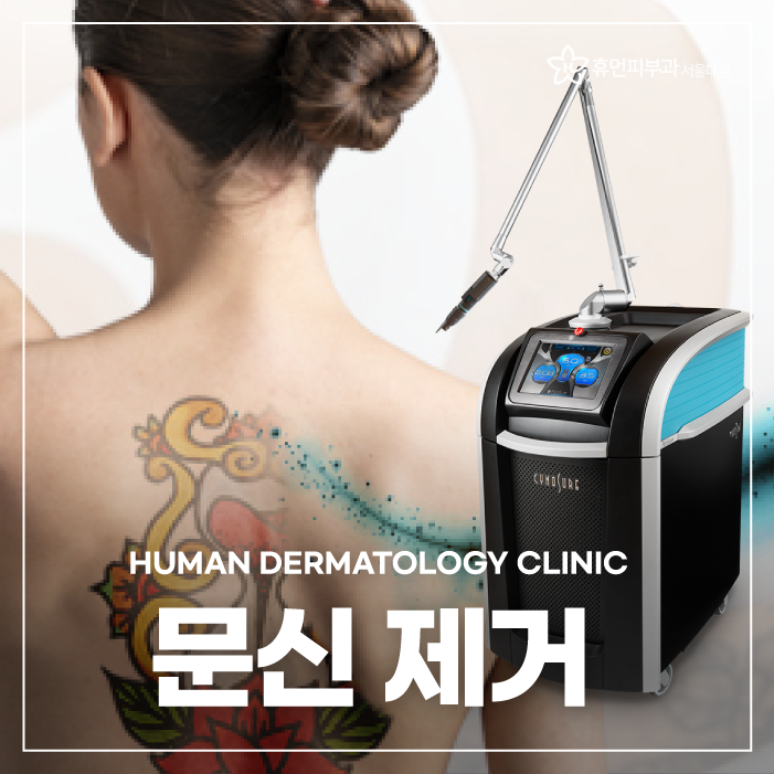 강남타투제거 깔끔하게 지워져 관련 이미지 1