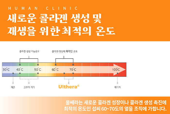 사당역피부과 울쎄라로 탄력 있는 내 피부 관련 이미지 3