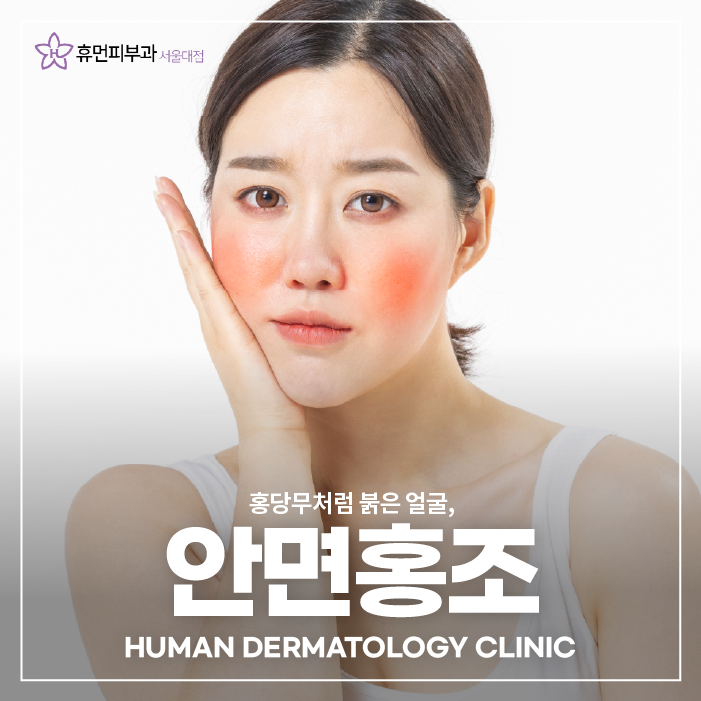 낙성대역피부과 안면홍조 관리법 관련 이미지 1