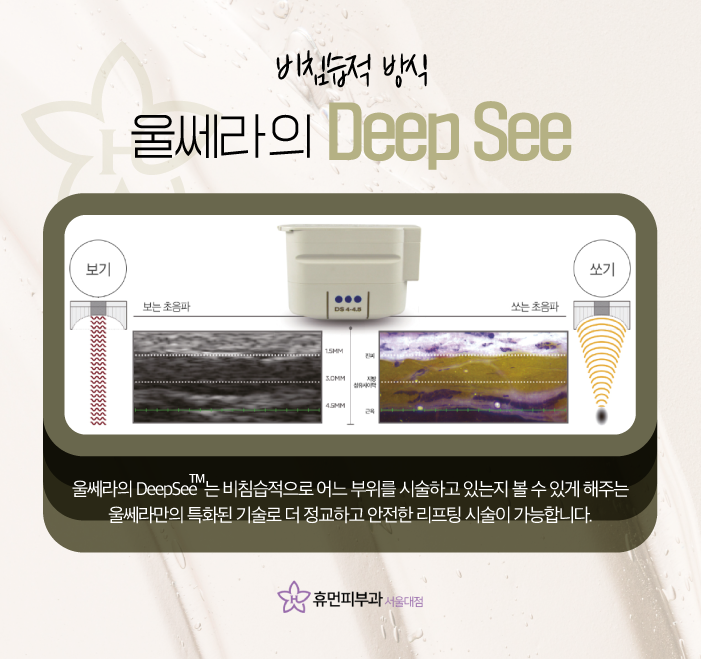 서울 관악구피부과 울쎄라 탄력 업 관련 이미지 4