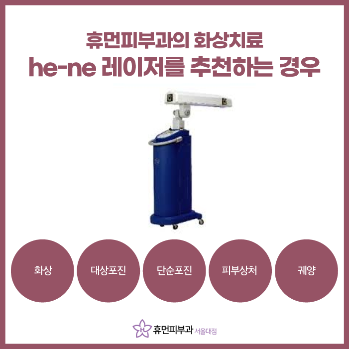 서울대입구역피부과 화상을 입으셨다면 관련 이미지 4