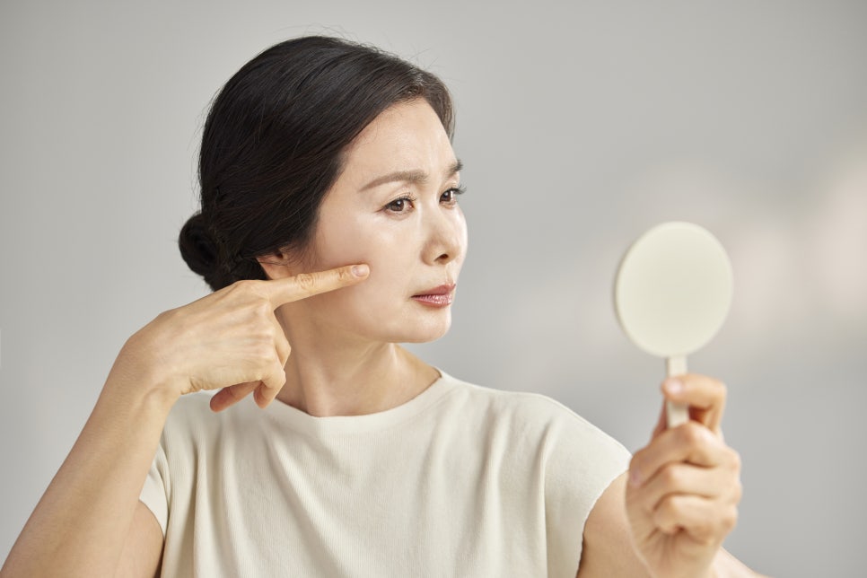 Why Does Melasma Develop? The Path Back to Clear Skin image 4