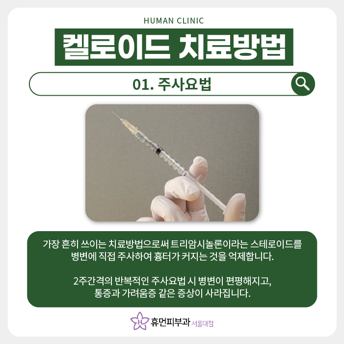 켈로이드피부과 최고의 치료 효과 보장하는 피부과? 관련 이미지 4