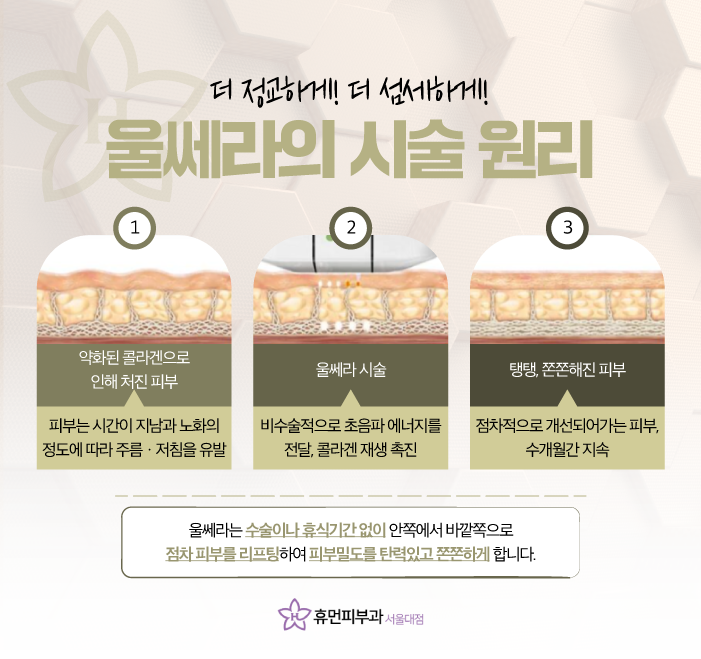 서울 관악구피부과 울쎄라 탄력 업 관련 이미지 5