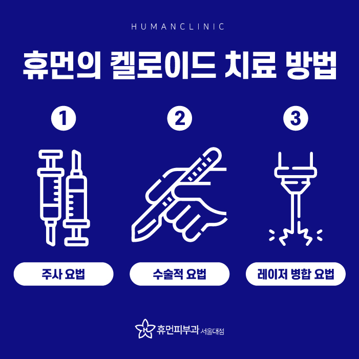 장승배기피부과 켈로이드 알아보려고 한다면? 관련 이미지 4