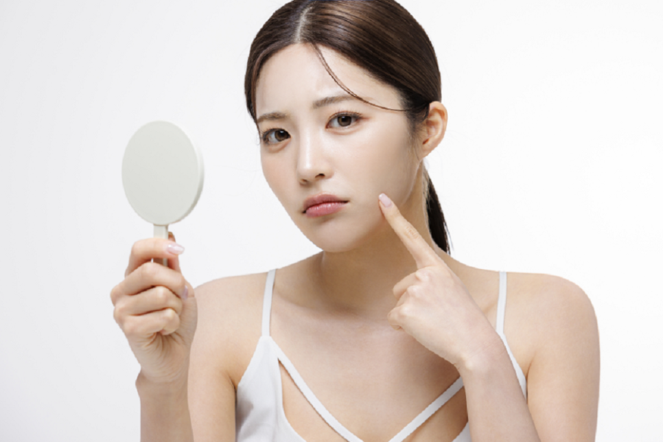Will Acne Scars Naturally Improve Over Time? image 3