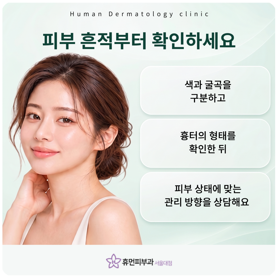 서울대입구피부과 여드름흉터, 자국일까 흉터일까 먼저 구분해요 관련 이미지 7