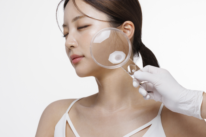 Why Does Acne Keep Coming Back? When Dermatological Treatment Is Needed image 4