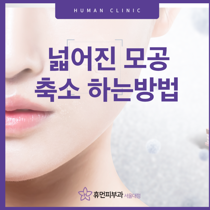 모공축소하는방법 알고 쫀쫀하게 관련 이미지 1