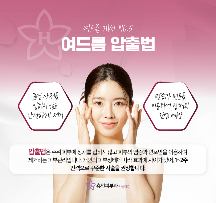 서울 신길 여드름 피부과 다양한 관리 방법은 관련 이미지 7