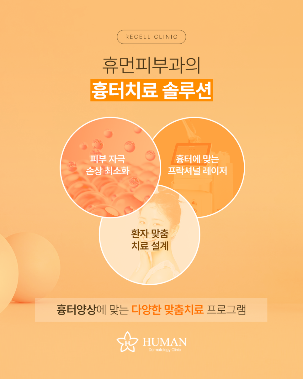 How Should Acne Scars Be Treated? Human Dermatology Seoul National University Entrance Station Branch image 3