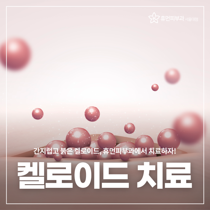 켈로이드피부과 어떻게 치료하나요 관련 이미지 1