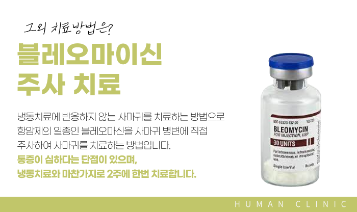 서울대역피부과 사마귀치료 더 심해지기 전에 관련 이미지 10