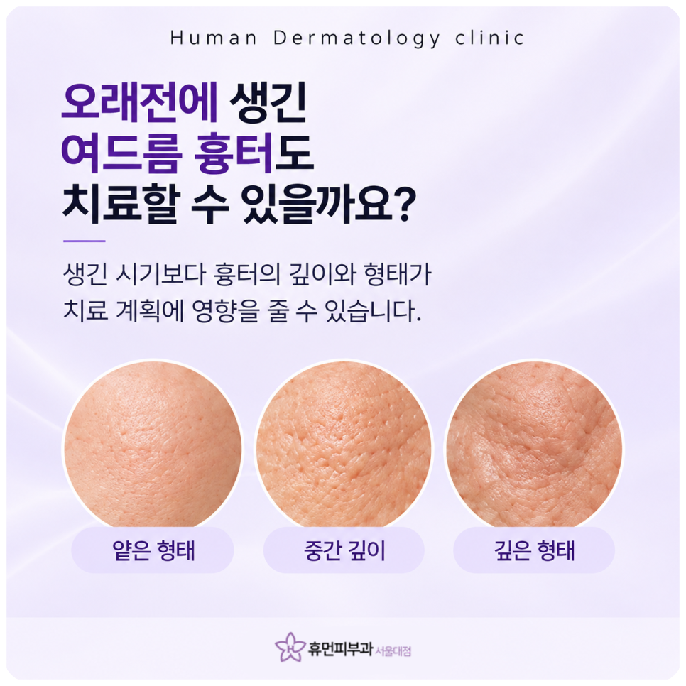 이수역피부과 여드름흉터, 같은 시술인데 회복과 변화가 다른 이유 관련 이미지 3
