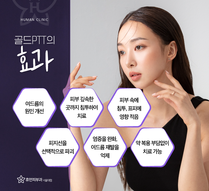 서울 방배동 여드름 피부과 보라매역피부과 깨끗한 얼굴 만들기 관련 이미지 6