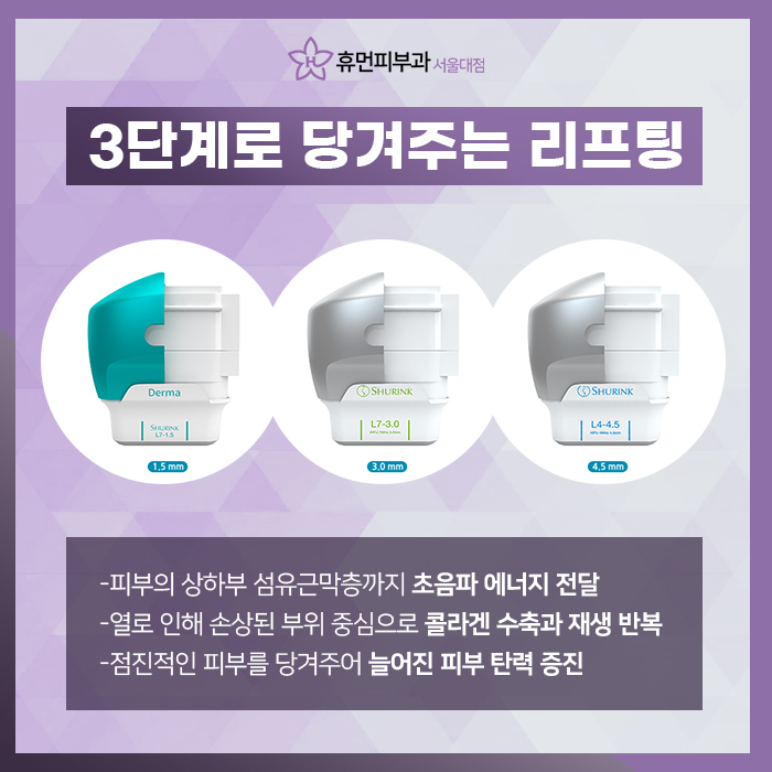 슈링크300샷효과 어떤 게 있을까? 관련 이미지 4