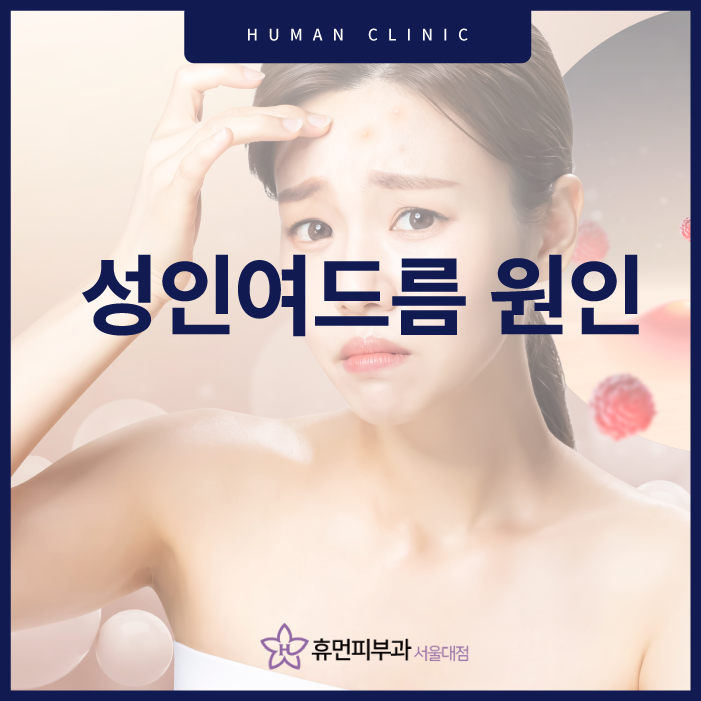 성인여드름의원인 왜?생기는걸까 관련 이미지 1