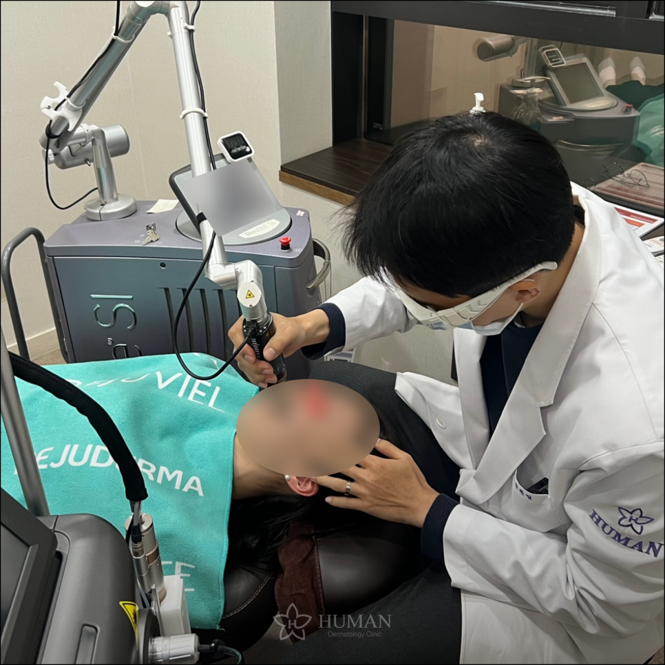 서울대입구역피부과 실리프팅 비용? 00만원이면 됩니다. 관련 이미지 7