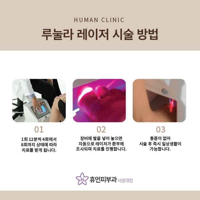 관악구피부과 손발톱 무좀치료 부담없이 관련 이미지 9