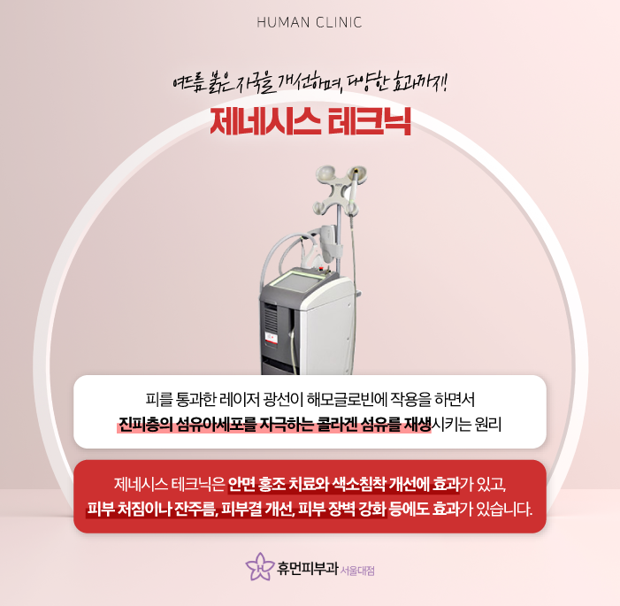 여드름자국레이저 여드름 제네시스 브이빔 LDM으로 여드름관리 해보자 관련 이미지 5
