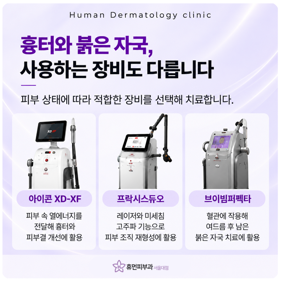 이수역피부과 여드름흉터, 같은 시술인데 회복과 변화가 다른 이유 관련 이미지 5