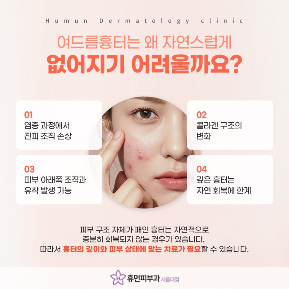 서울대입구역 여드름흉터치료, 흉터 유형에 맞춘 치료가 중요 관련 이미지 4