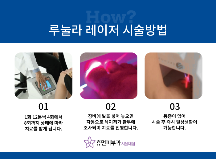 난곡동피부과 발톱무좀 재발은 이제 그만 관련 이미지 3