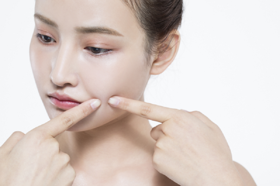 How Is Dermatology Extraction Care Different from Squeezing at Home? image 2