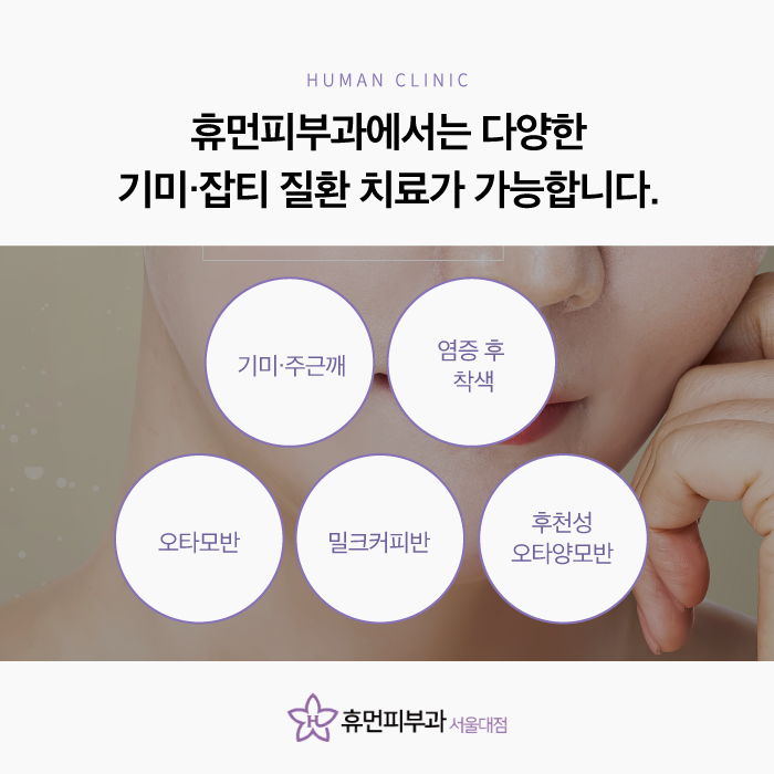서울대입구피부과추천 잡티없이 깨끗하게 관련 이미지 3