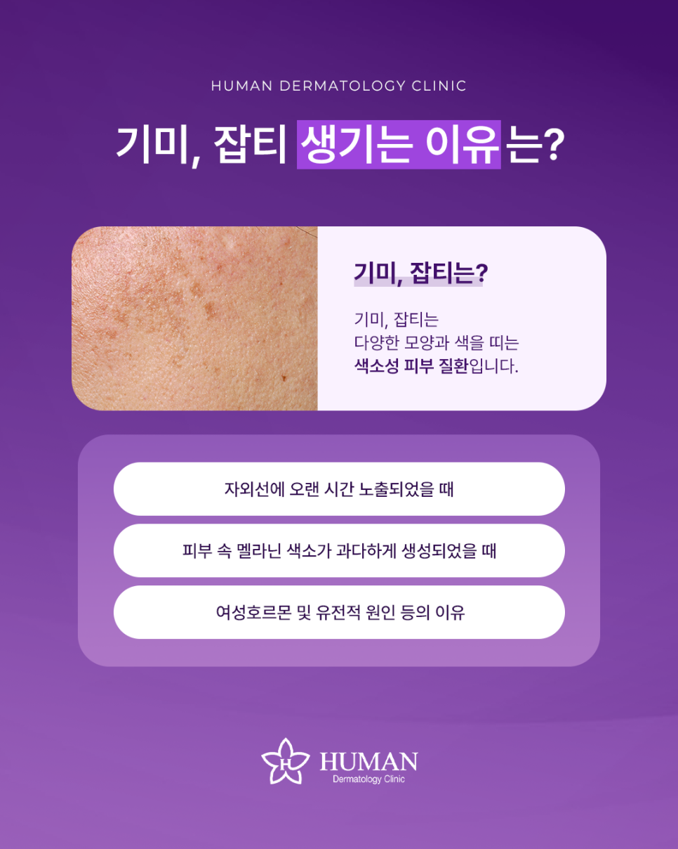 If You're Looking for a Place Near Seoul National University Entrance Station for Freckle and Melasma Removal and Pigment Treatment image 2
