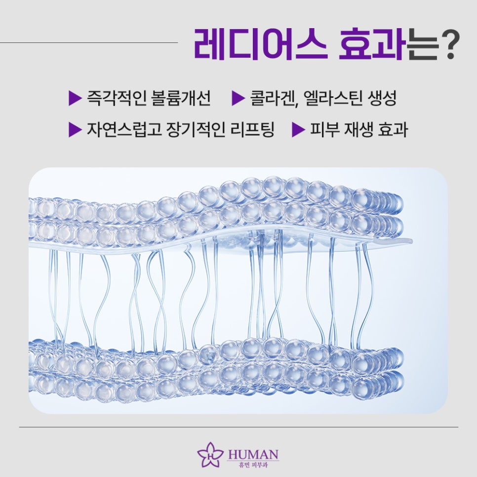 Sillim Radiesse: Natural Volume and Elasticity image 4