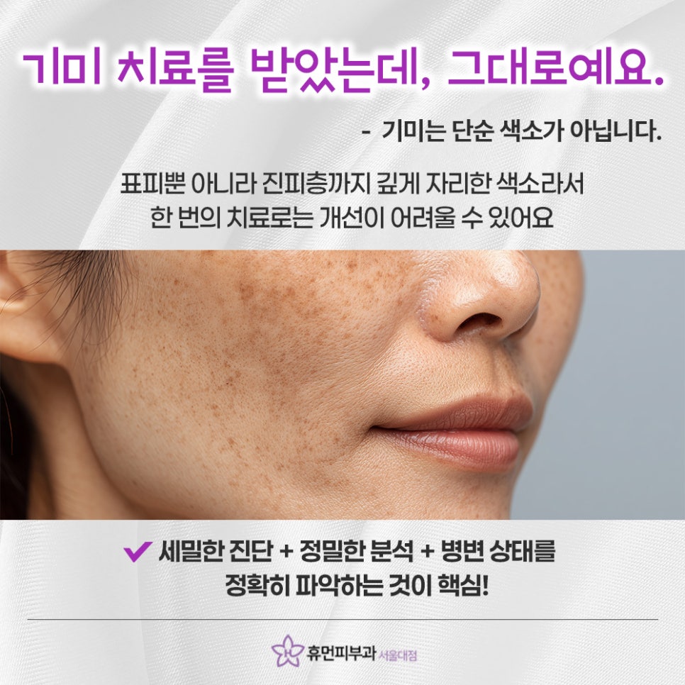 Why Pigmentation Laser Treatment at Sadang Station Doesn’t Make Melasma Disappear at Once image 4