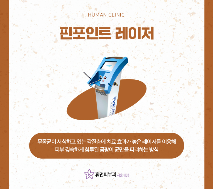 무좀치료법 제대로 알아보고 싶다면? 관련 이미지 4