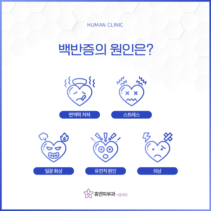 서울대입구역피부과 백반증 치료하고 싶다면? 관련 이미지 4