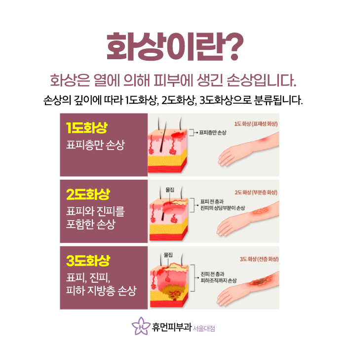 서울대입구역피부과 화상을 입으셨다면 관련 이미지 2