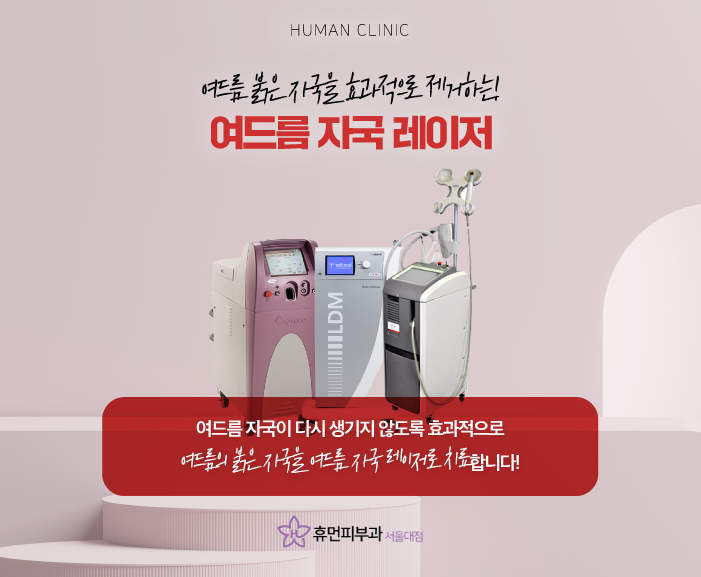 여드름자국레이저 여드름 제네시스 브이빔 LDM으로 여드름관리 해보자 관련 이미지 3