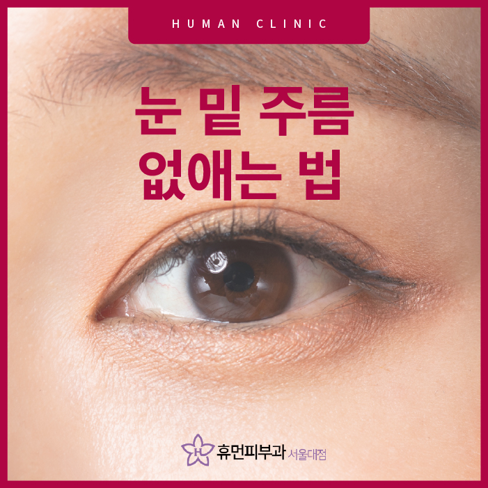 눈밑주름없애는법 어떤 게 있을까요? 관련 이미지 1