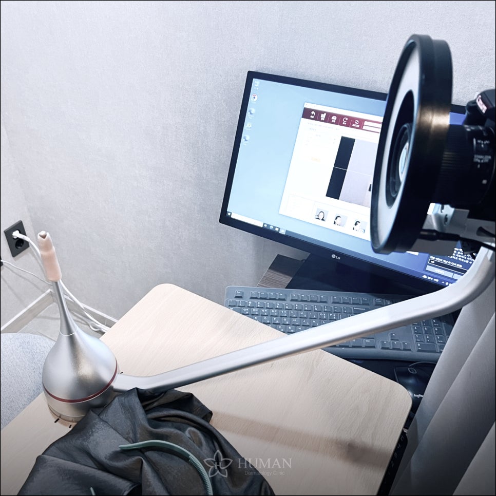 서울대입구 보톡스 가격을 보기 전에 oo을 확인하세요 관련 이미지 4