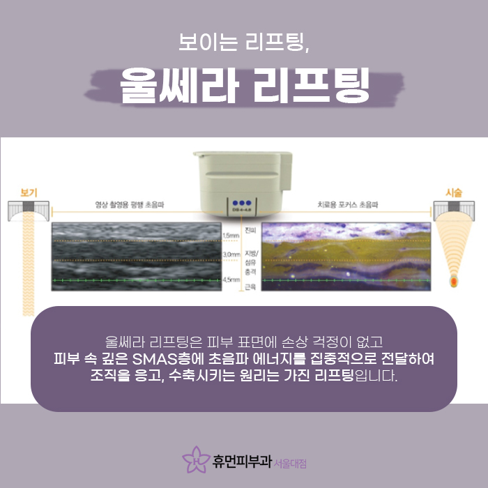 울쎄라병원 피부과전문의에게 받아야하는 이유! 관련 이미지 2
