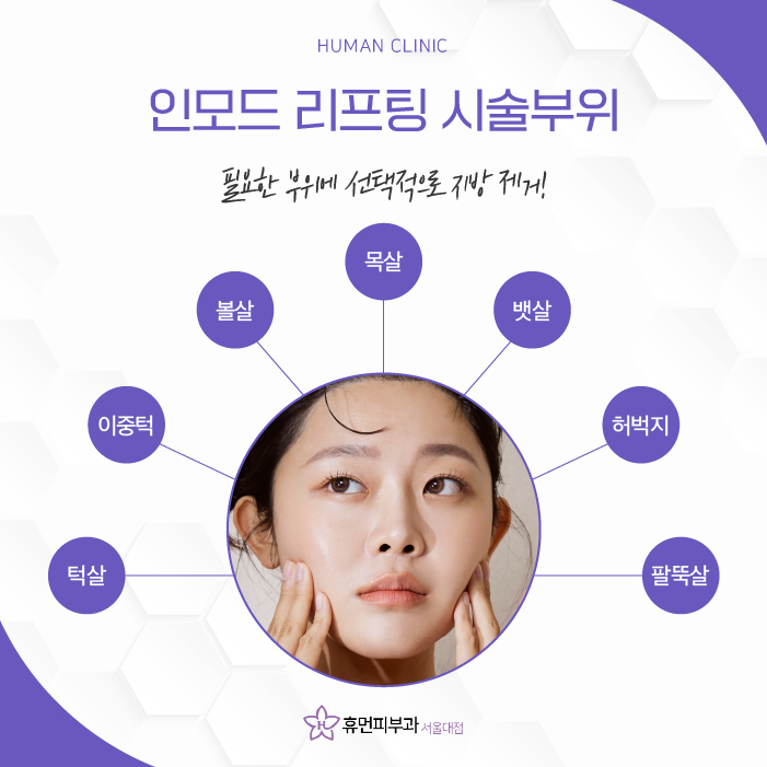 서울인모드 노화로 인한 이중턱이 고민이라면? 관련 이미지 4