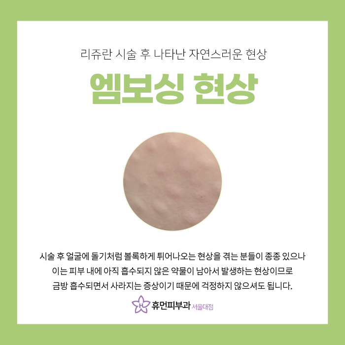 숭실대피부과 휴먼피부과 리쥬란 스킨부스터로 생기 있는 얼굴 만들어요! 관련 이미지 5