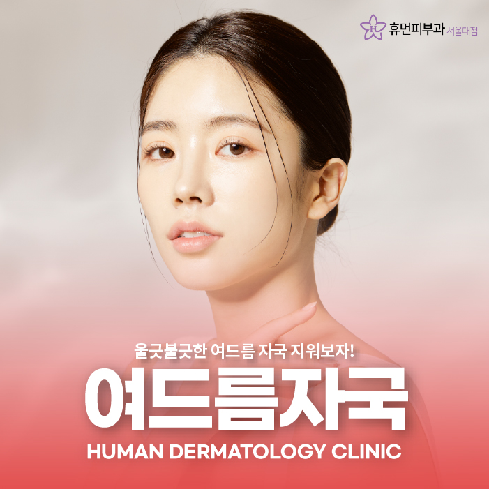 흑석동피부과 여드름 자국으로 말미암은 스트레스, 어떻게 개선해야 할까 관련 이미지 1