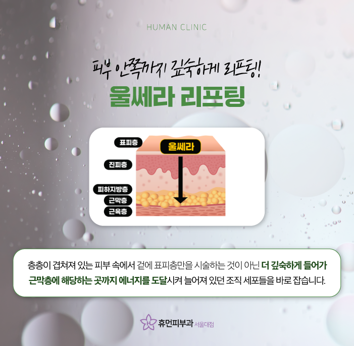 문래동피부과 울쎄라가격 효과로 주름 없는 얼굴 동안 이미지 만들어보자 관련 이미지 5