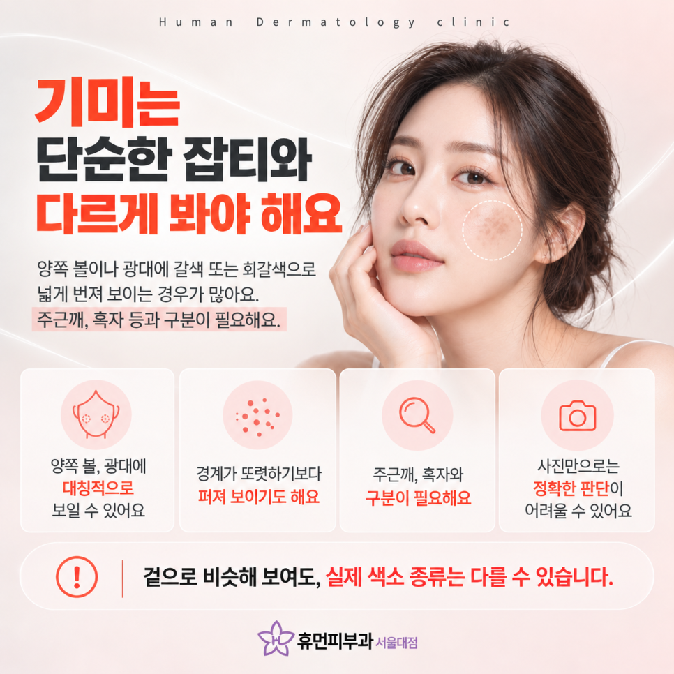 사당역피부과 기미, 왜 좋아졌다가 다시 진해질까요? 관련 이미지 3