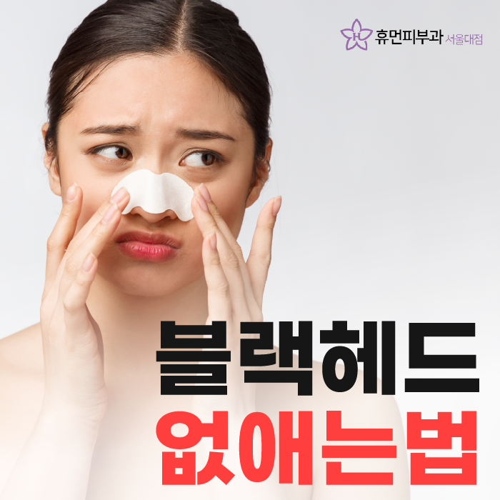 블랙헤드없애는법 자극없이 깨끗하게 관련 이미지 1